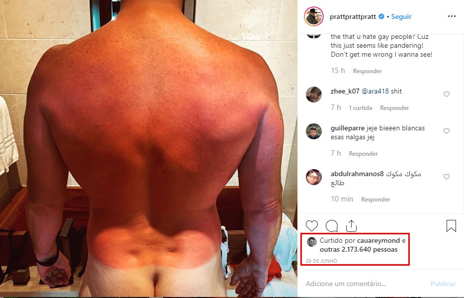 Nudes de Chris Pratt bomba na web com milhares de acessos